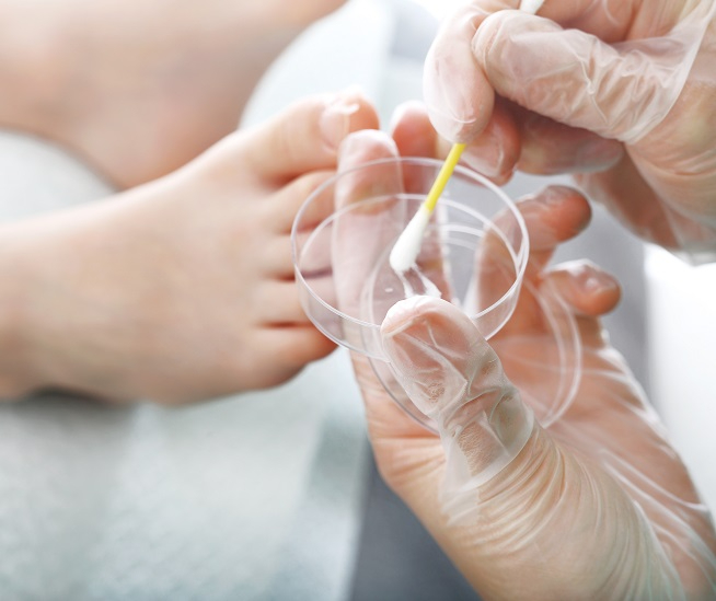 badanie mykologiczne paznokci