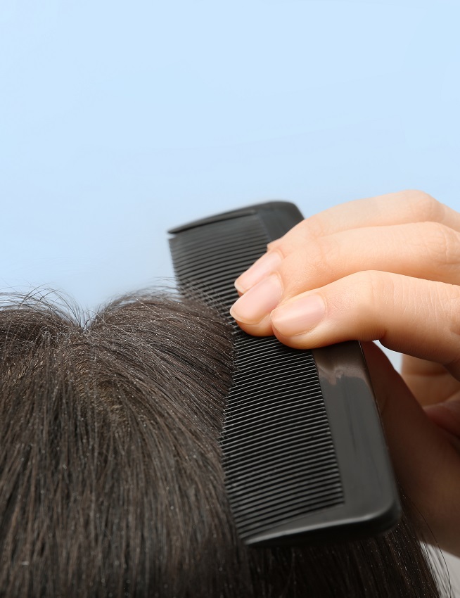 domowy peeling skóry głowy