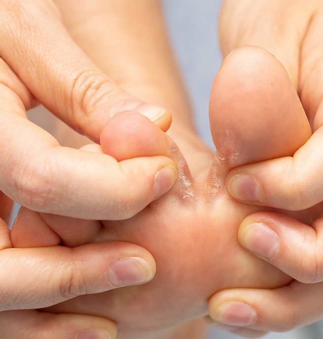 sposoby na grzybicę paznokci u stóp