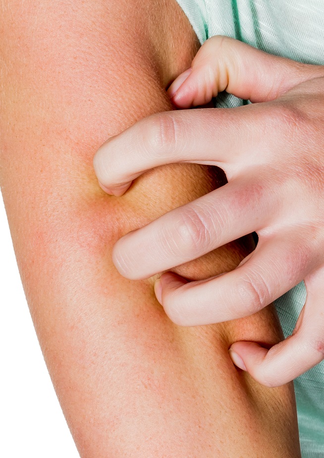 jak można się zarazić gzybicą