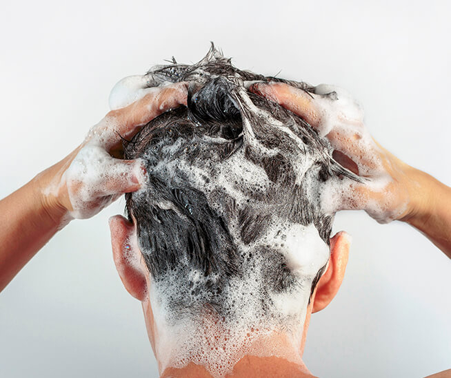 swędzenie skóry głowy