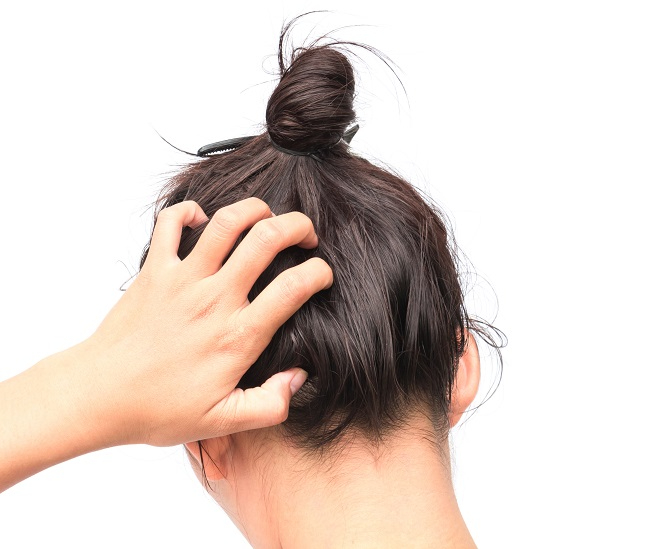 swędzenie skóry głowy