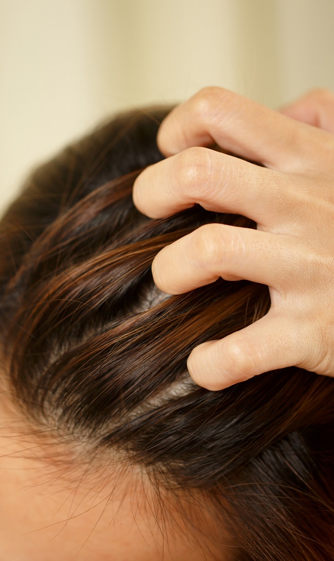 wypadanie włosów z cebulkami